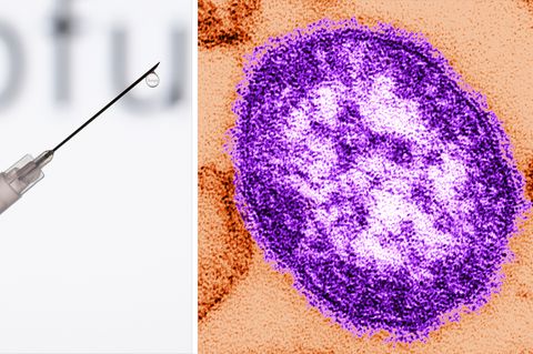 Masern in Europa: Eine Spritze und ein Masern-Virus