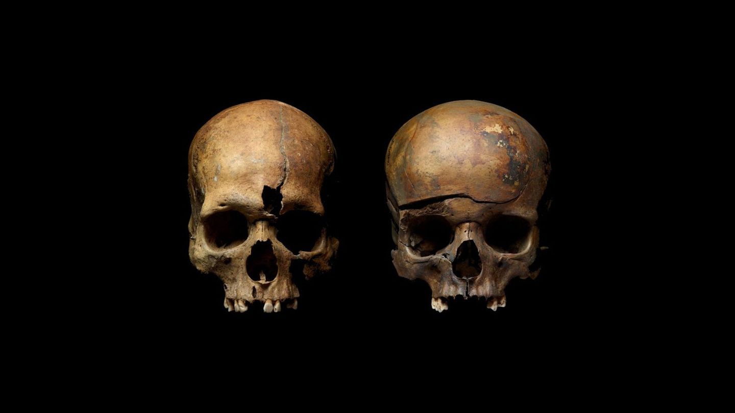 Die Toten zeigen Spuren extremer Gewalt. Links sind die Spuren eine Einstichs in die Stirn zu sehen, der Schädel rechts ist geborsten.