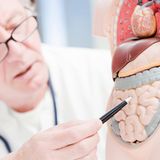 Früherkennung von Darmkrebs: Ein Arzt zeigt auf ein Modell des menschlichen Darms