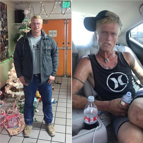 Vorher-Nachher-Bild eines Drogenabhängigen