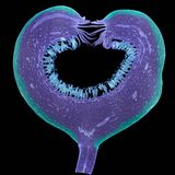 "Ficus" zeigt eben jene Pflanze, genauer: den Längsschnitt der sich noch entwickelnden Frucht