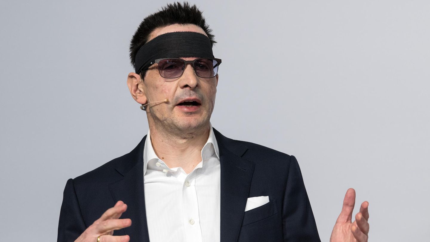 Innogy-Manager Bernhard Günther ein Jahr nach dem Säureanschlag