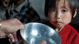 Kim Nam Hui (4 Jahre) ist stark mangel- und unterernährt