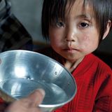 Kim Nam Hui (4 Jahre) ist stark mangel- und unterernährt