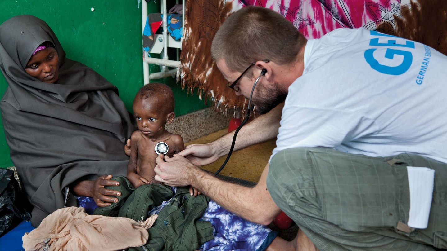 Somalia: Der Krankenpfleger Philippe Valentin untersucht Muqtaav. Er ist zwei Jahre alt, wiegt 5,9 Kilo und ist damit schwer unterernährt. Somalia: Der Krankenpfleger Philippe Valentin untersucht Muqtaav