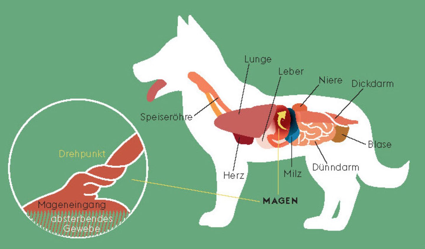 Illustration einer Magendrehung