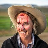 Caitlyn Taussigmit einer klaffenden Wunde auf der Stirn