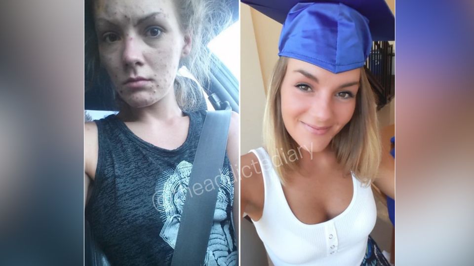Ex-Drogennutzer vor und nach dem Entzug: Facebookseite macht Menschen Mut
