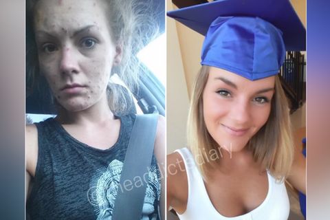 Ex-Drogennutzer vor und nach dem Entzug: Facebookseite macht Menschen Mut