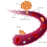 Metastasen in der Forschung