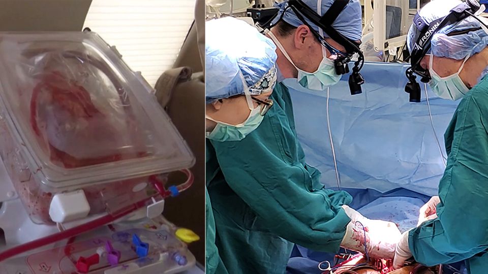 Collage: Menschliches Herz, Operation
