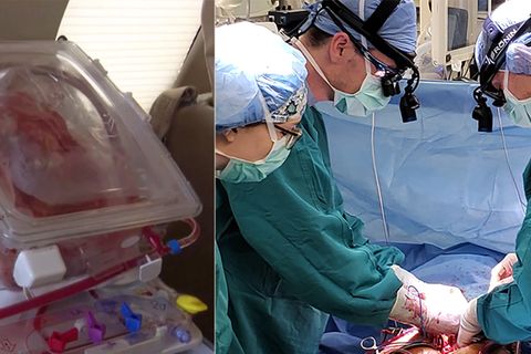 Collage: Menschliches Herz, Operation