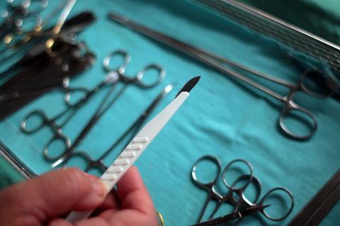 Eine Hand hält ein Skalpel über ein Tablett mit OP-Besteck