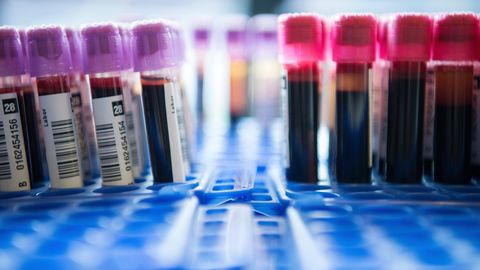 PSA-Test: Röhrchen mit Blutproben stehen in einem Labor