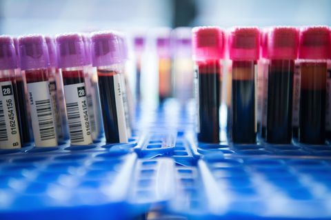 PSA-Test: Röhrchen mit Blutproben stehen in einem Labor