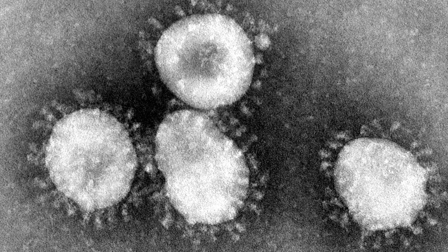 Lungenkrankheit in China: Coronavirus unter dem Mikroskop