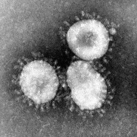 Lungenkrankheit in China: Coronavirus unter dem Mikroskop