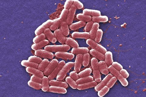 Sepsis: E.coli-Bakterien im Mikroskop