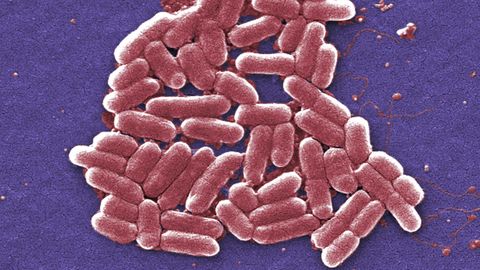 Sepsis: E.coli-Bakterien im Mikroskop