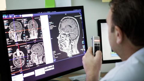 Ein Arzt schaut sich einen MRT-Scan des Kopfes eines Patienten an