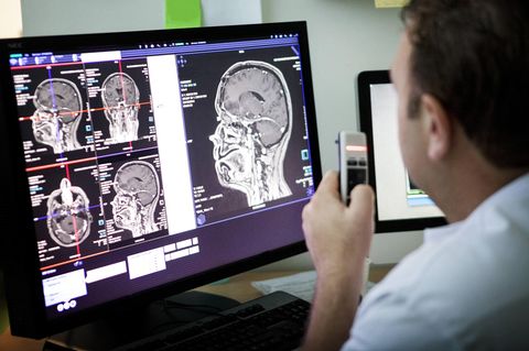 Ein Arzt schaut sich einen MRT-Scan des Kopfes eines Patienten an