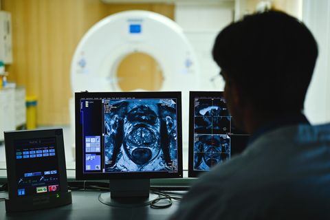 Auf einem Monitor im Kontrollraum des Deutschen Krebsforschungszentrum erscheint das Querschnittsbild einer Prostata