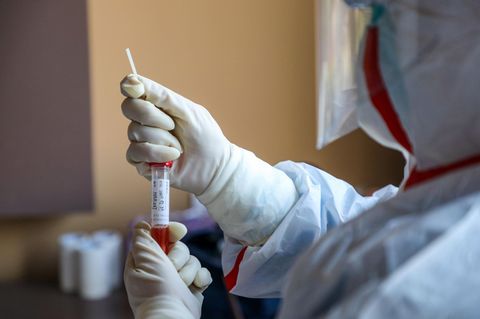 Coronavirus: Eine Probe wird auf das Coronavirus getestet
