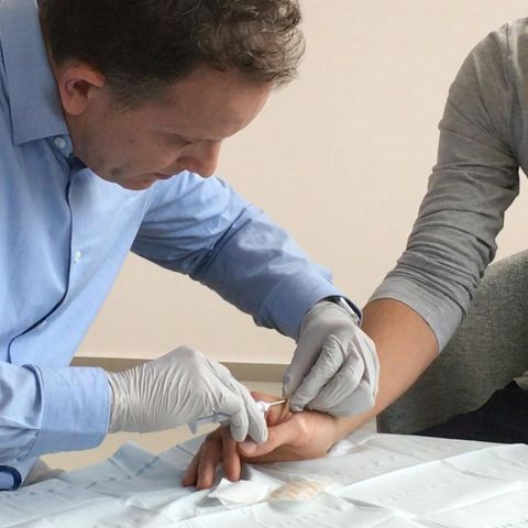 Horror oder Fortschritt? Patrick Kramer implantiert Mikrochips unter die Haut