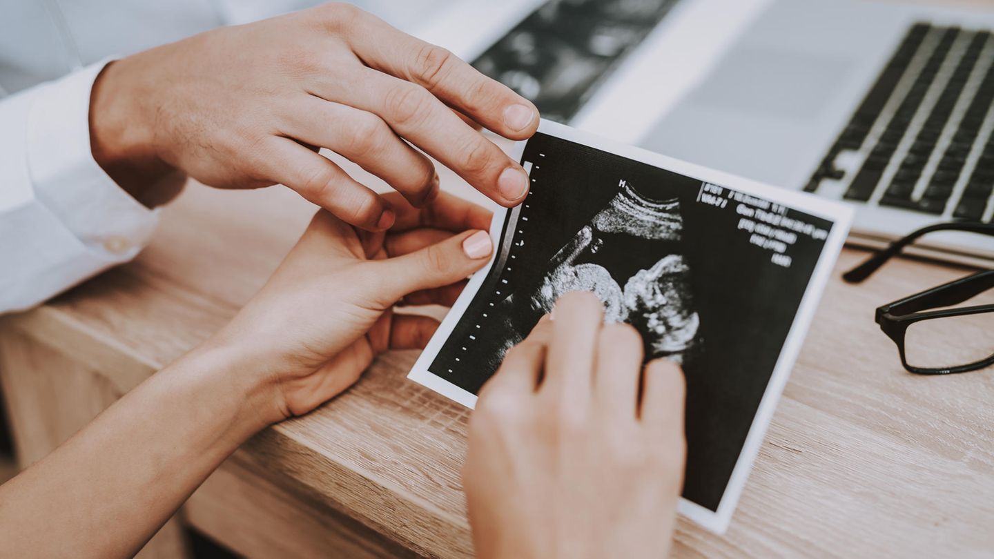 Schwangerschaft nach Fehlgeburt: Eine Frau hält eine Ultraschall-Aufnahme in der Hand