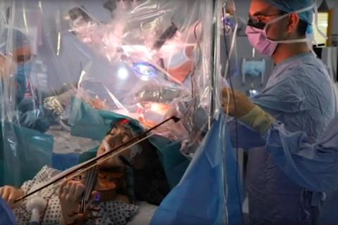 Eine Patientin spielt Geige, während Chirurgen einen Tumor aus ihrem Gehirn entfernen.