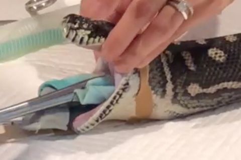 Lebensbedrohlicher "Snack": Tierärzte ziehen ein ganzes Handtuch aus Python