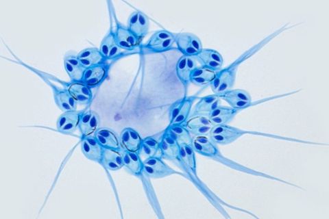 "Henneguya salminicola" ist ein mehrzeliges Lebewesen, das keinen Sauerstoff benötigt.