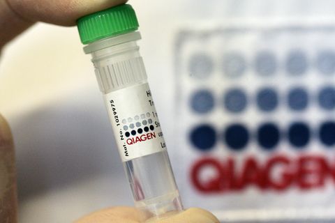 Das Biotech-Unternehmen Qiagen hat einen Corona-Schnelltest entwickelt - und wird nun von einem US-Konzern übernommen