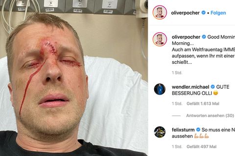 Oliver Pocher Instagram Jagdunfall