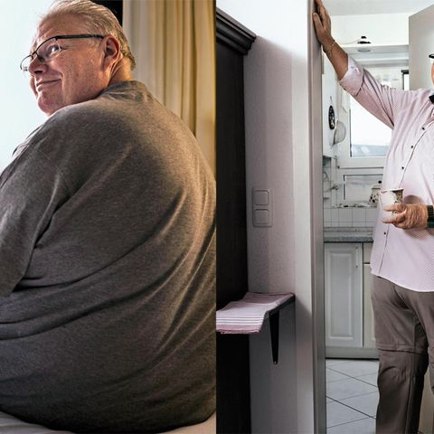 Bernhard Kaltenschnee vor (l.) und nach der OP