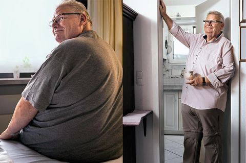 Bernhard Kaltenschnee vor (l.) und nach der OP
