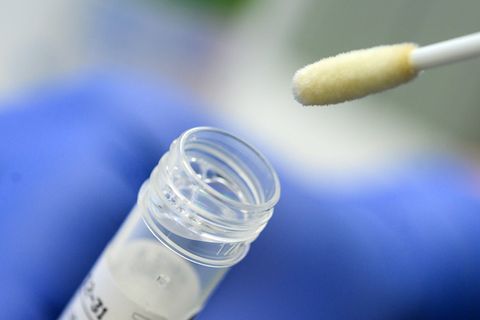 Abstrich für das Testverfahren auf das Virus SARS-CoV-2