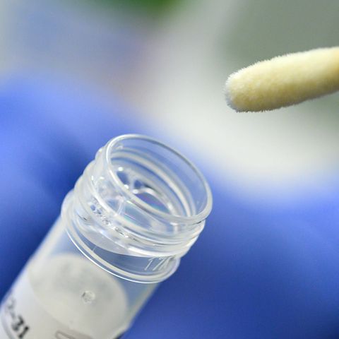 Abstrich für das Testverfahren auf das Virus SARS-CoV-2