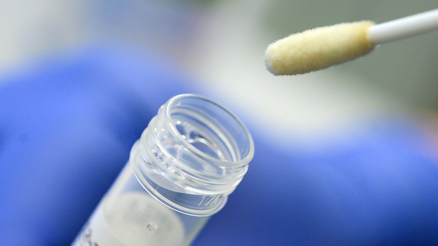 Abstrich für das Testverfahren auf das Virus SARS-CoV-2