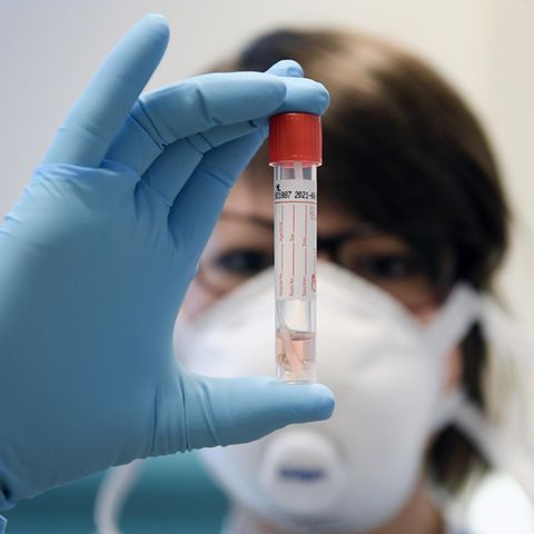 Eine Laborantin überprüft einen Corona-Test. Unsere Autorin kämpft seit Tagen darum, getestet zu werden. 