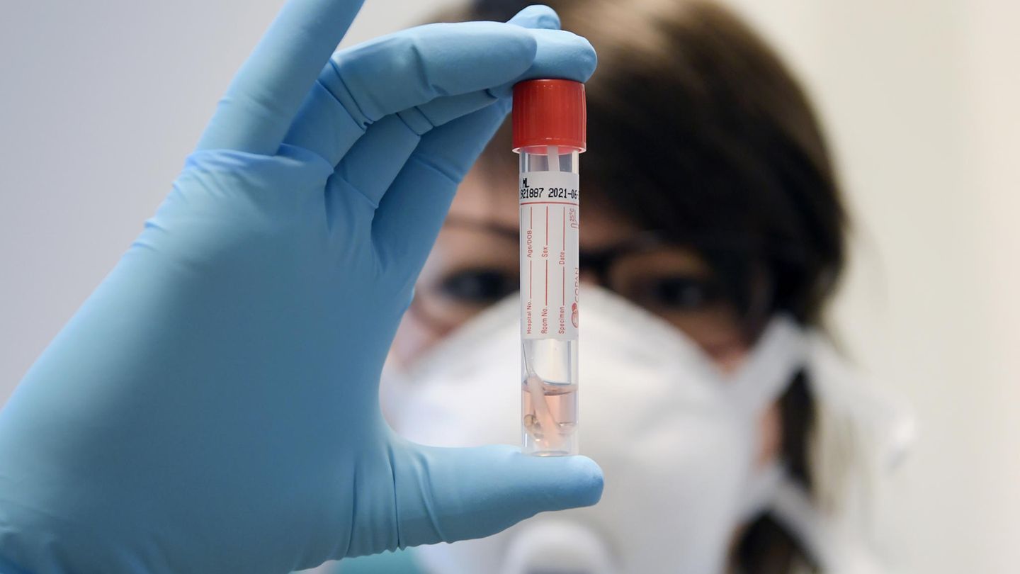 Eine Laborantin überprüft einen Corona-Test. Unsere Autorin kämpft seit Tagen darum, getestet zu werden. 