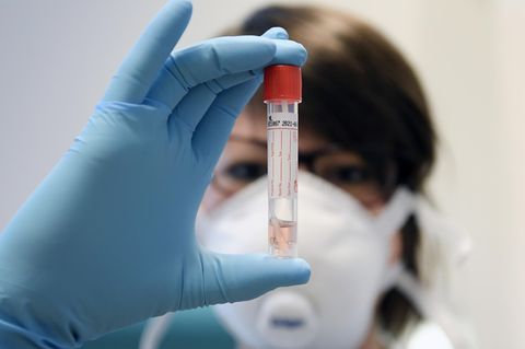 Eine Laborantin überprüft einen Corona-Test. Unsere Autorin kämpft seit Tagen darum, getestet zu werden. 