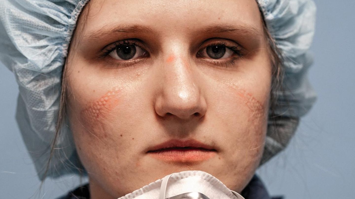 DOCTORS AND NURSES OF THE INTENSIVE CARE HOSPITAL, FIGHTING COVID-19 EMERGENCY IN PESARO - ITALY. THEY ARE PORTRAITED AT THE END OF THEIR LONG WORKSHIFT. 12 HOURS WITH NO DRINK AND NO TOILETBREAK, DUE TO THE PROTECTIVE SUIT THEY WEAR. THE SIGNS ON THEIR... Eleonora Hulsof