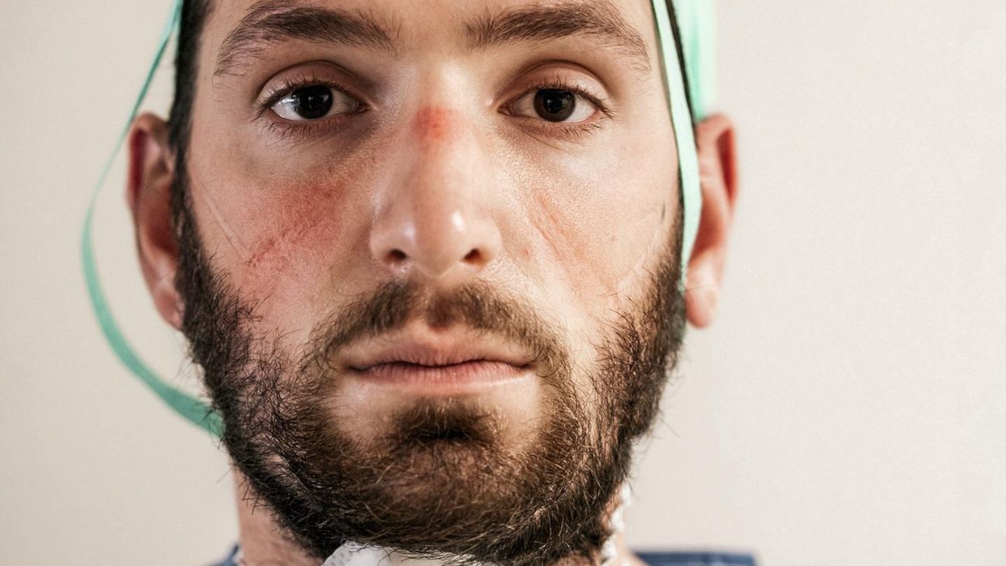 DOCTORS AND NURSES OF THE INTENSIVE CARE HOSPITAL, FIGHTING COVID-19 EMERGENCY IN PESARO - ITALY. THEY ARE PORTRAITED AT THE END OF THEIR LONG WORKSHIFT. 12 HOURS WITH NO DRINK AND NO TOILETBREAK, DUE TO THE PROTECTIVE SUIT THEY WEAR. THE SIGNS ON THEIR... Federico Paolin