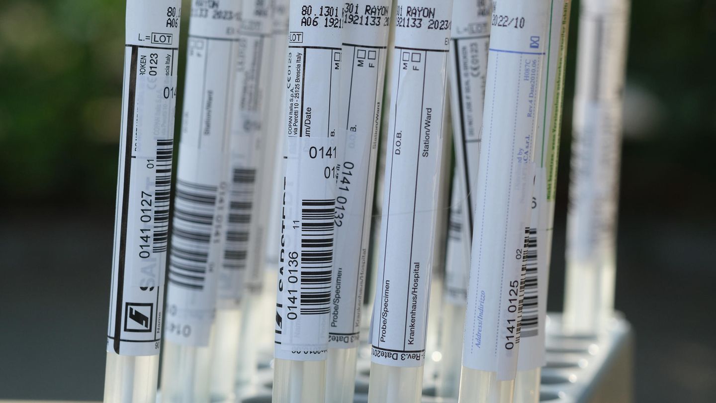 Abstriche von Coronavirus-Tests