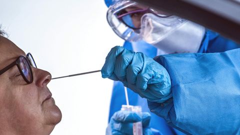 Experten großflächige, einheitliche Tests in Deutschland.