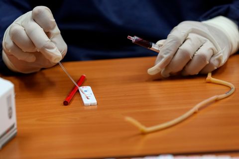 Auf einem Schreibtisch ruhen zwei Hände in Gummihandschuhen. Die rechte Hand reibt ein Wattestäbchen an einem Teststreifen