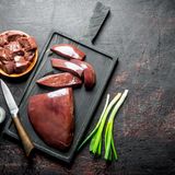 In Leber steckt Kupfer