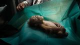 Bestes Foto in der Kategorie "Natur": Der Körper eines einmonatigen Orang-Utans liegt auf dem Operationstuch eines Rettungsteams auf Sumatra. Das Tier starb kurz nachdem es mit der verletzten Mutter auf einer Palmölplantage gefunden wurde. Titel: "Final Farewell".