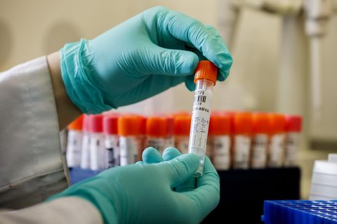 Eine Covid-19-Probe wird in einem Hamburger Labor untersucht.